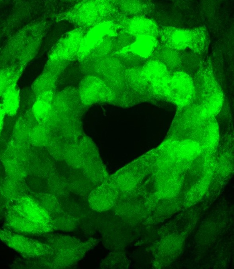 Cardiomyocytes