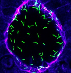 Left-right cilia in Kupffer’s vesicle
